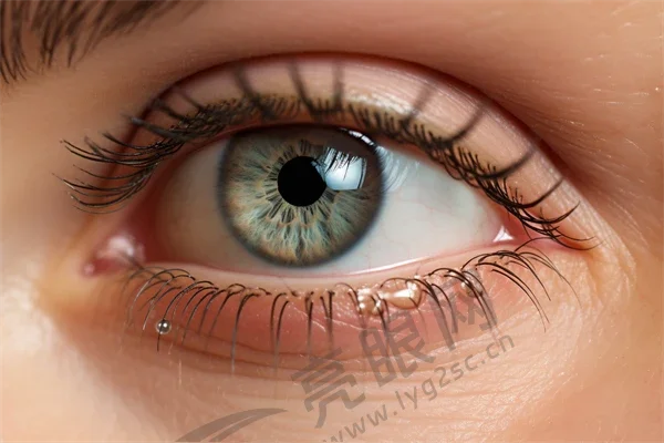 （三）陕西西安优视美眼科晶体植入近视手术价格表