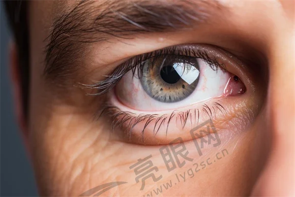 深圳飞秒近视手术哪家好?眼科医院排行top10揭晓