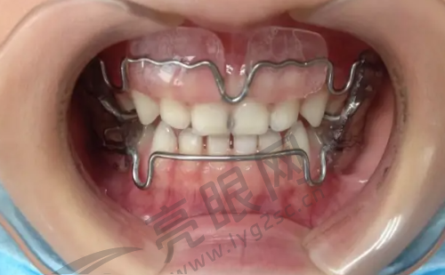 种牙价格实惠
