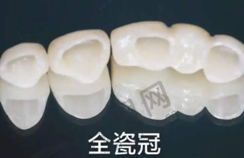 长沙牙祖口腔2025年价格表