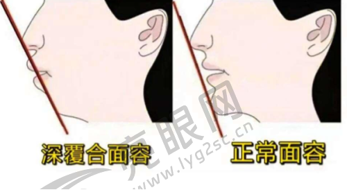 西安心牙口腔门诊部靠谱吗？环境舒适设备先进，医生经验足，韩系种植牙1880元起