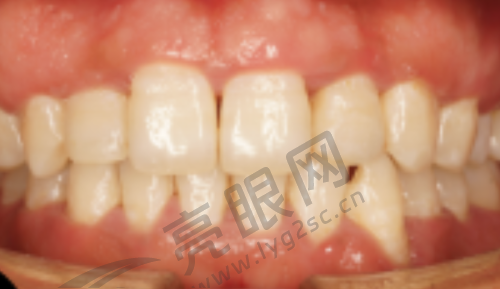 北京佳阳口腔门诊部靠谱吗？布局完善、项目多收费合理，设备护航解决牙齿问题